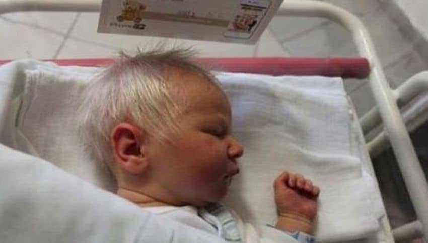 Il loro bambino nasce con i capelli bianchi, nessuno riesce a dare una spiegazione. Finché il medico non trova l’unica spiegazione.